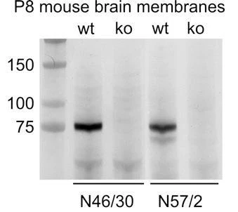 Anti-ADAM22 (Cytoplasmic) Antibody - Image 2