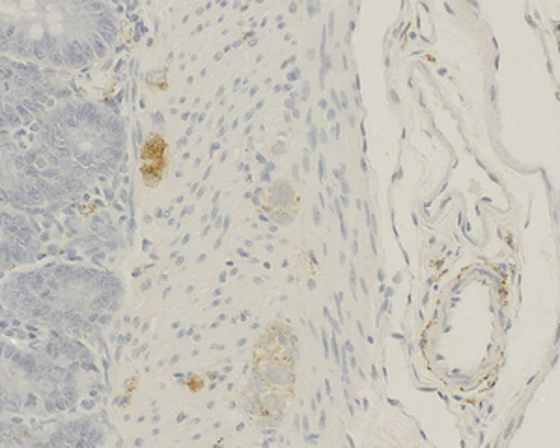 Primary Antibodies