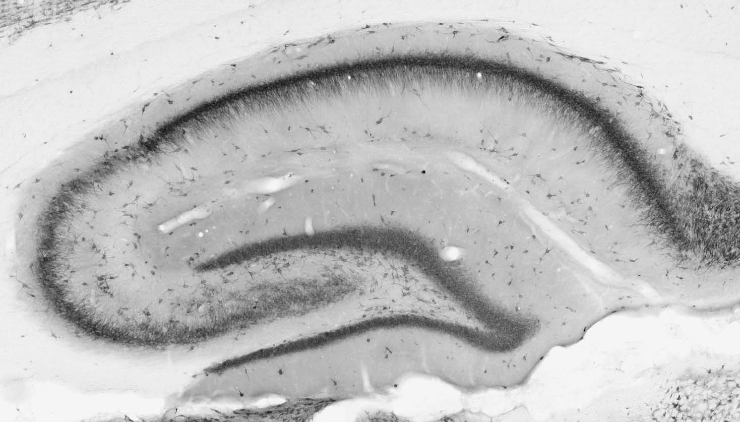 Anti-AMIGO-1 Antibody