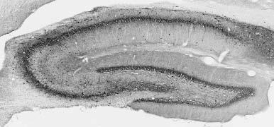 Anti-Ankyrin-R/G Antibody