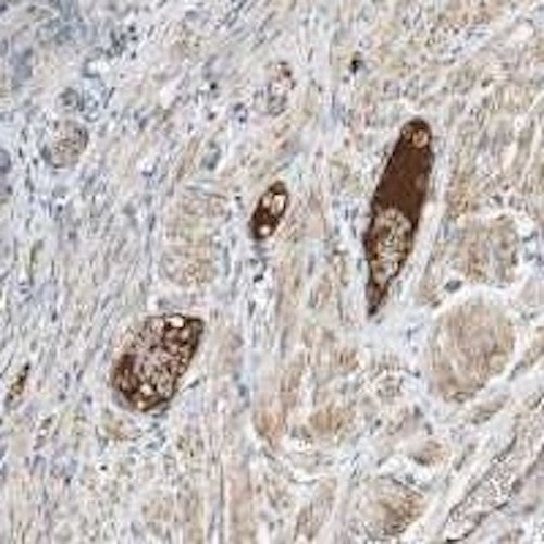 Anti-APC-AAT Complexes, Neoepitope Antibody