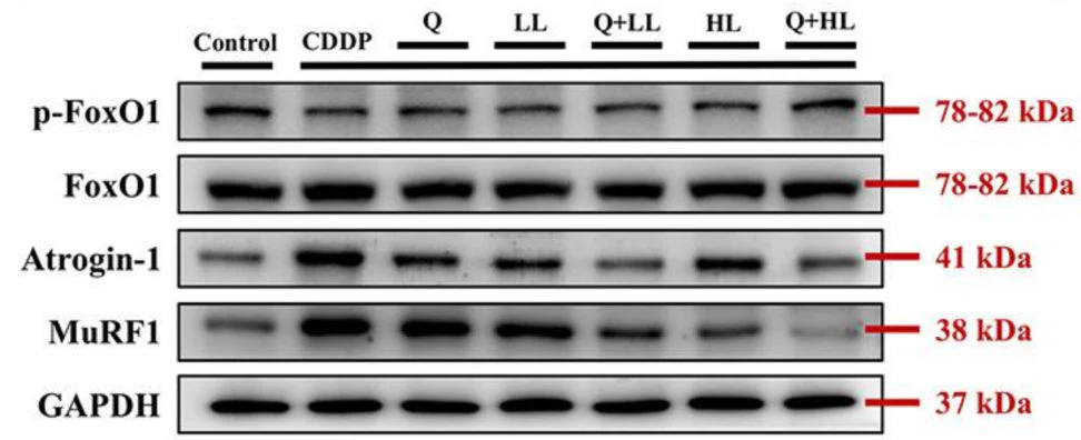 Anti-Atrogin-1 Antibody - Image 6