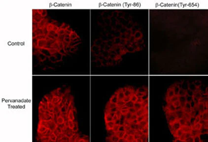 Anti-β-Catenin (Tyr-654) [γ-Catenin (Tyr-644)], Phosphospecific Antibody - Image 2