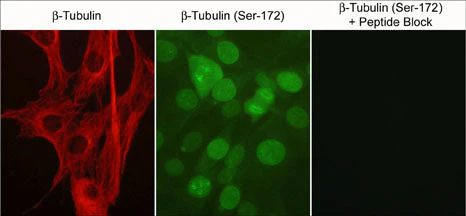 Anti-β-Tubulin Antibody - Image 2