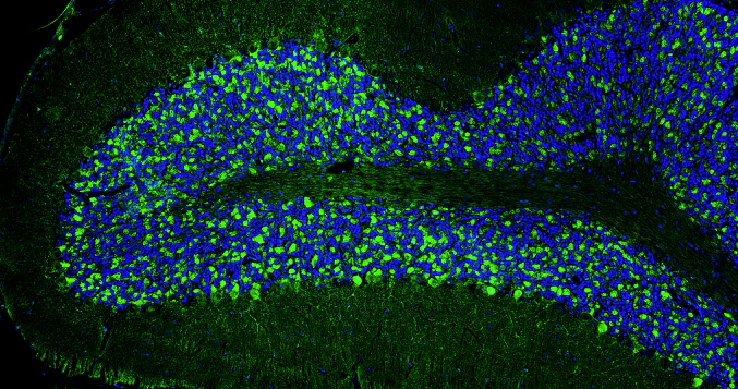 Anti-Bassoon Recombinant Chicken Chimeric mAb