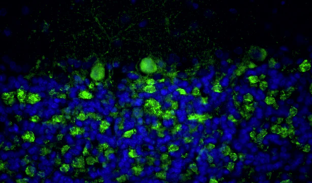 Anti-Bassoon Recombinant Chicken Chimeric mAb - Image 2