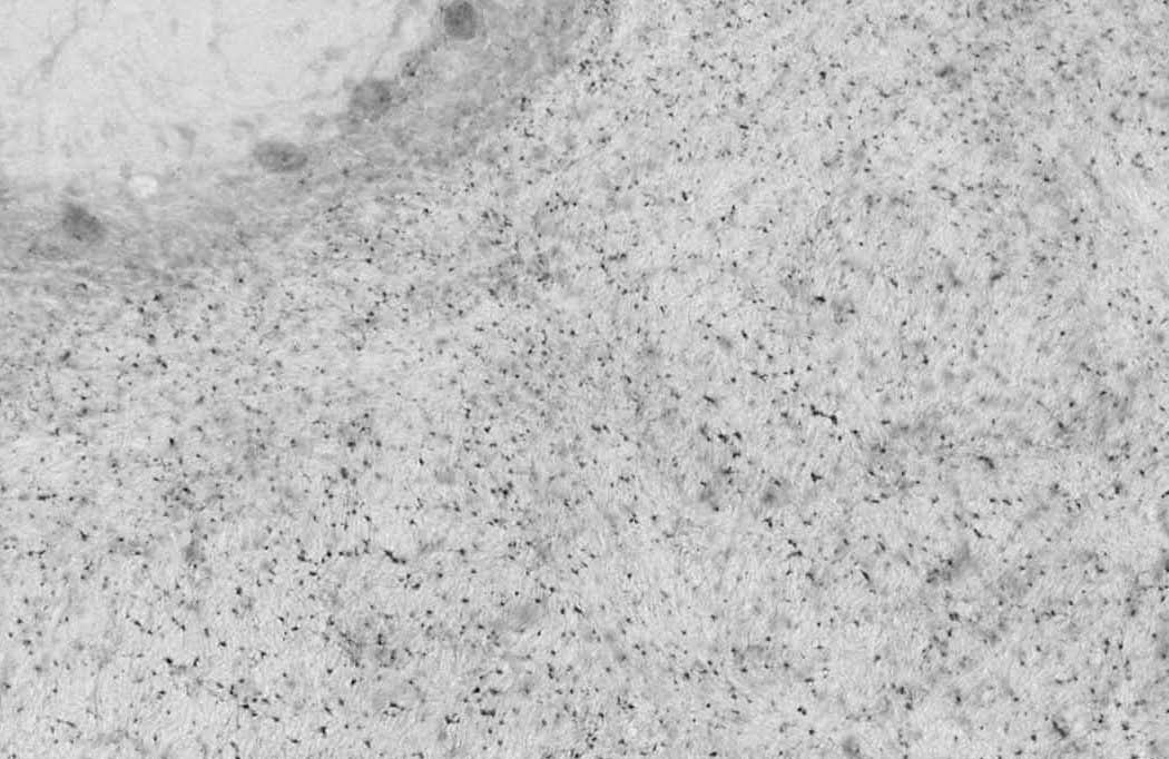 Anti-Bral1 Antibody - Image 4