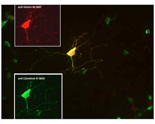 Anti-Calretinin (CR) Antibody - Image 2