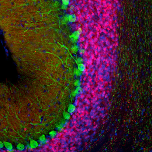 Anti-Calretinin Recombinant Chicken Chimeric mAb