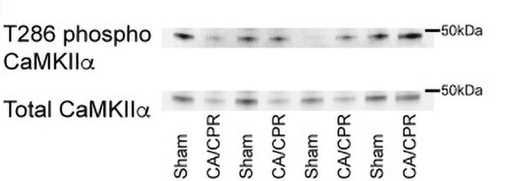 Anti-CaM Kinase II (Thr286) Antibody - Image 6