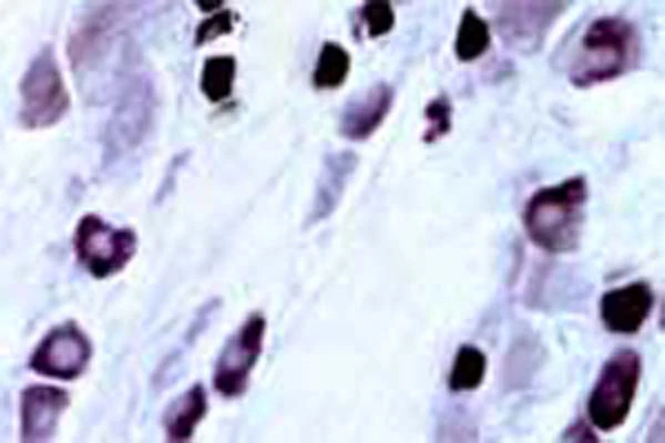 Anti-Capsaicin receptor (TrpV1) Antibody