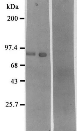 Polyclonal Antibodies