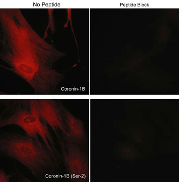 Anti-Coronin-1B (Ser-2), Phosphospecific Antibody - Image 2