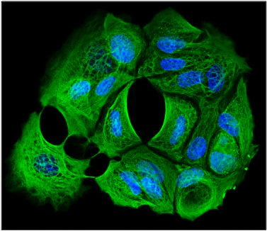 Anti-Cytokeratin Cocktail Antibody