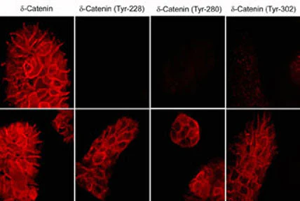 Anti-δ1-Catenin (central region) Antibody - Image 2