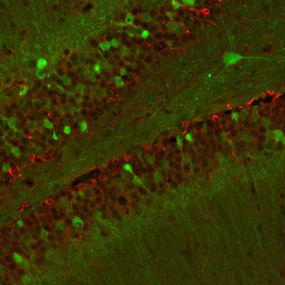 Anti-Doublecortin Antibody - Image 3