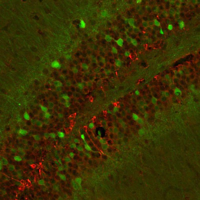 Anti-Doublecortin Antibody - Image 4