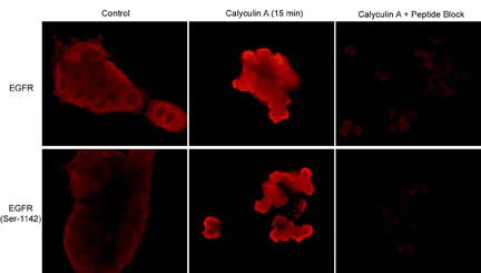 Anti-EGFR (Ser-1142), Phosphospecific Antibody - Image 2