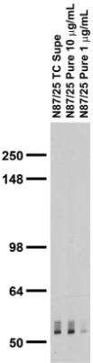 Anti-GABA-A-R, Beta3 Antibody