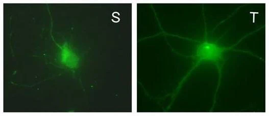 Anti-GABA-A-R, Delta Antibody - Image 2