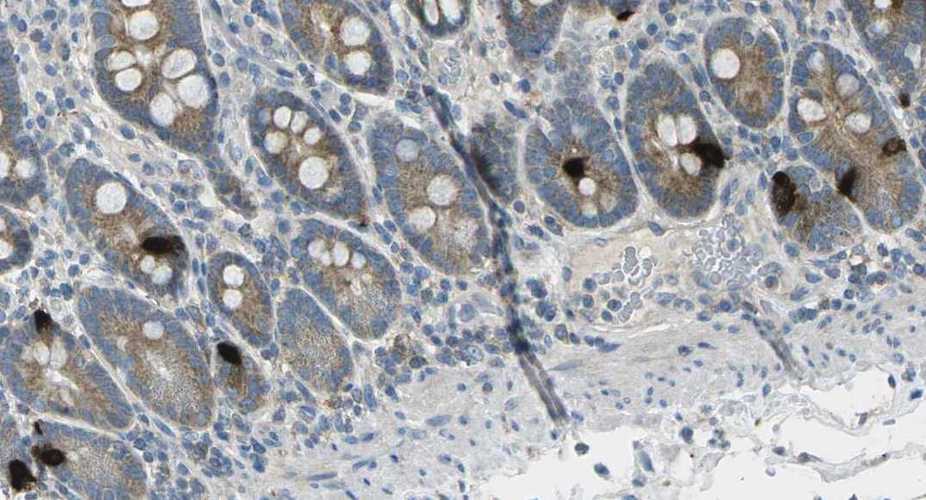 NeuroMab Antibodies - Antibodies Inc Official Supplier