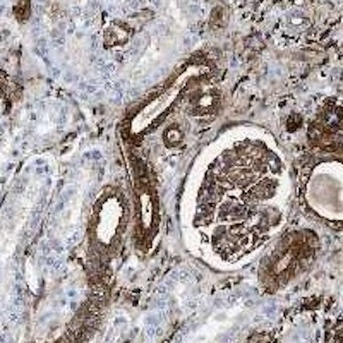 Anti-Gelsolin Antibody - Image 2