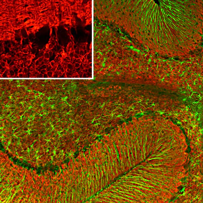 Anti-Glial Fibrillary Acidic Protein (GFAP) Antibody - Image 8