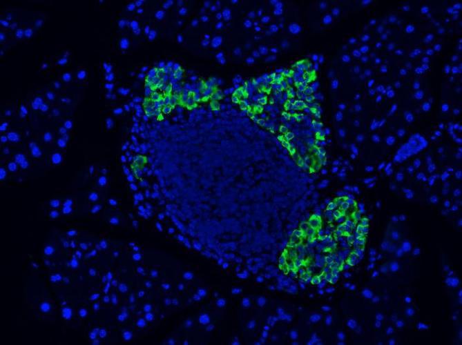 Monoclonal Antibodies