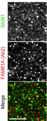 Anti-GluN1/NR1 Glutamate Receptor Antibody - Image 6