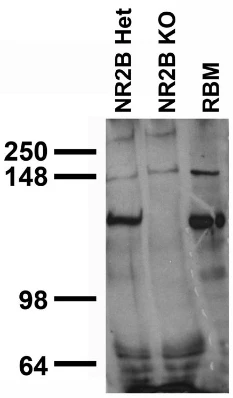 Anti-GluN2B/NR2B Glutamate Receptor Antibody - Image 2