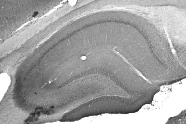 Anti-GluN2B/NR2B Glutamate Receptor Antibody - Image 3