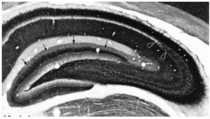 Anti-Kv1.1 K+ Channel Antibody - Image 4