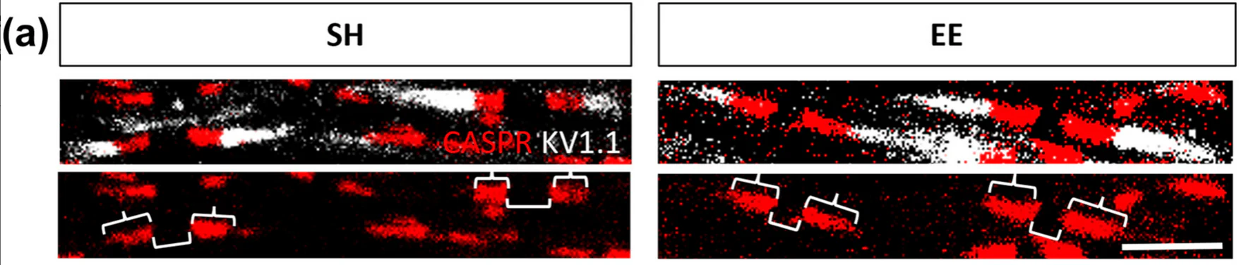 Anti-Kv1.1 K+ Channel (External) Antibody - Image 4