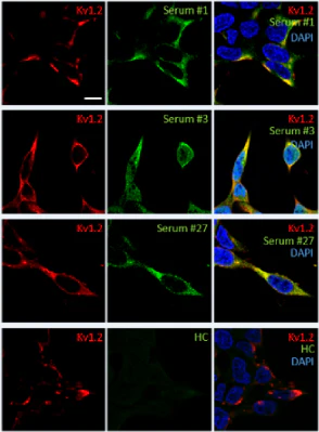 Anti-Kv1.2 K+ Channel Antibody - Image 9