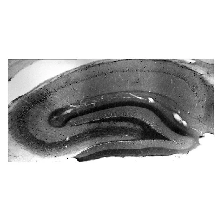 Anti-Kv1.4 K+ Channel Antibody - Image 3