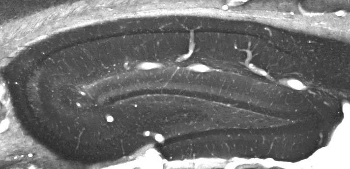 Anti-Kvbeta2 K+ Channel Antibody - Image 3