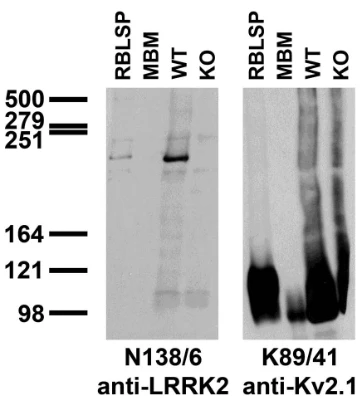 Anti-LRRK2/Dardarin, N-Terminus Antibody