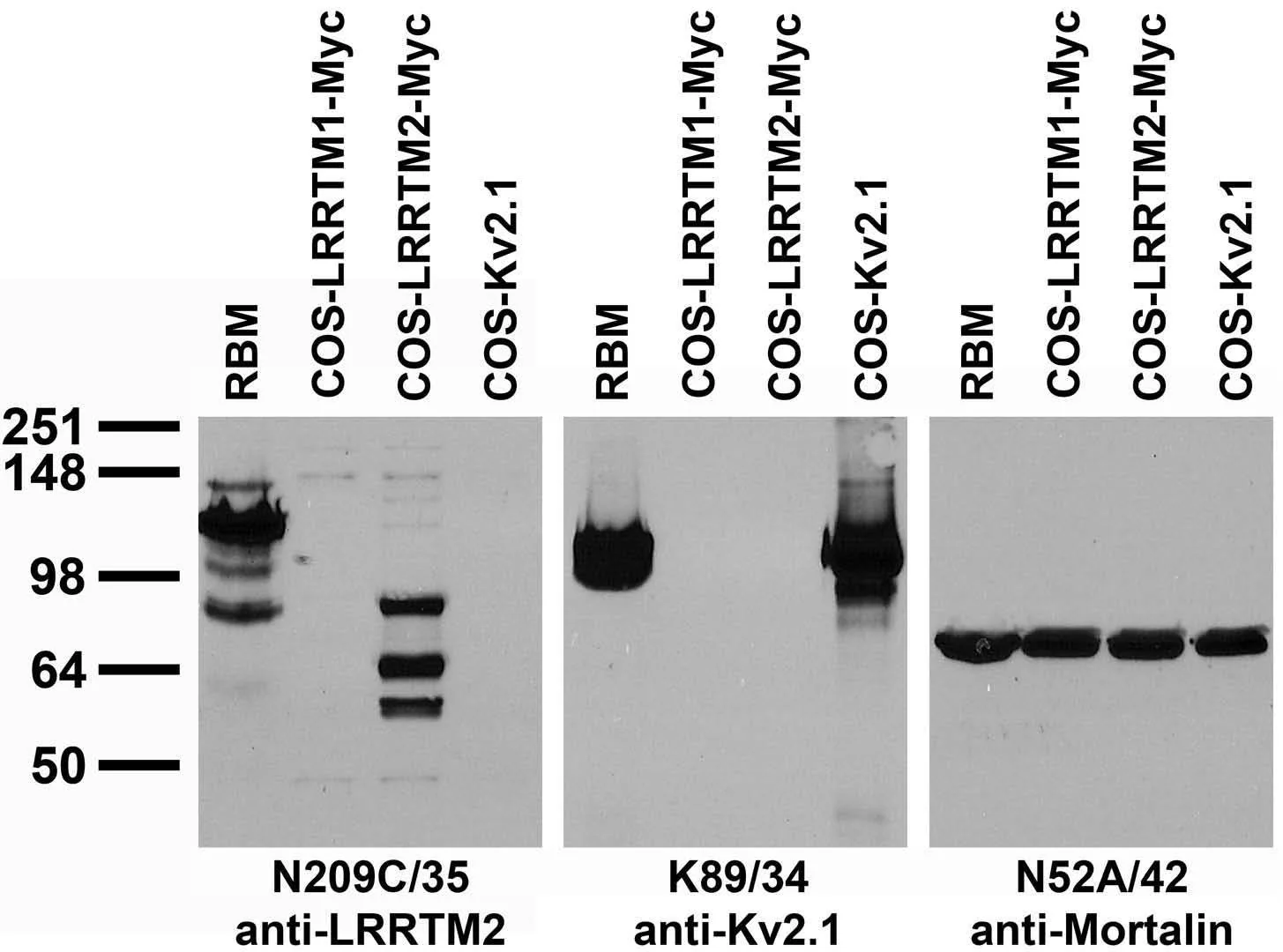 Anti-LRRTM2 Antibody