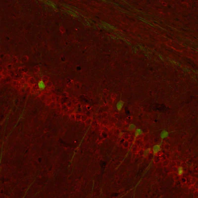 Anti-Metabotropic Glutamate Receptor Type 2/Type 3 (mGluR2/mGluR3) Antibody - Image 3