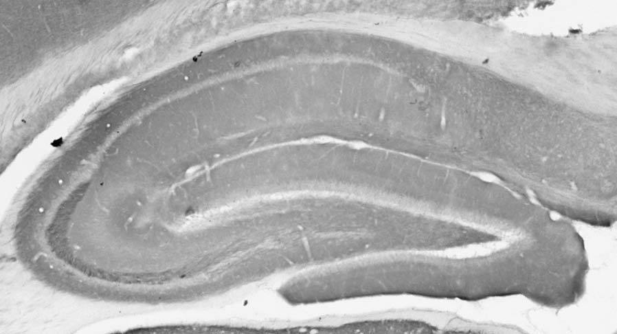 Anti-mGluR1/5 (Group I) Glutamate Receptor Antibody - Image 2