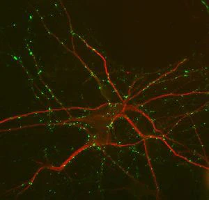 Anti-Microtubule Associated Protein 2 (MAP2) Antibody - Image 4