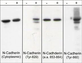Anti-N-Cadherin (C-terminal region) Antibody
