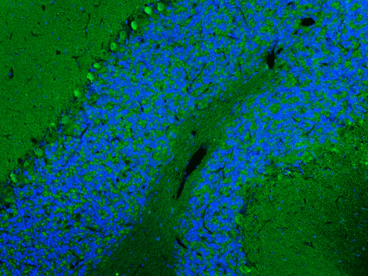 Anti-Nav1.1 Na+ Channel Recombinant Chicken Chimeric mAb