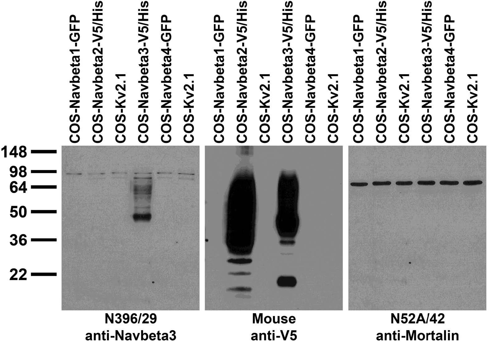 Anti-Navbeta3 Na+ Channel Antibody