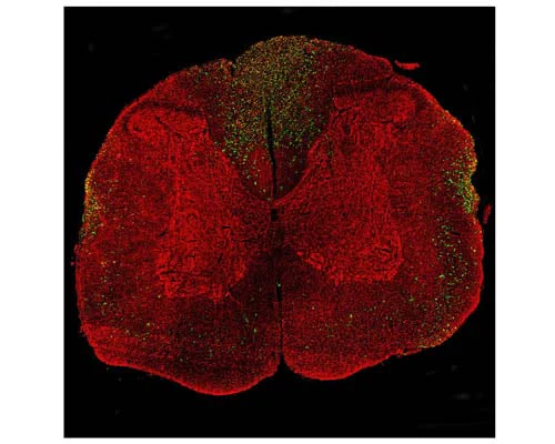Anti-Neurofilament light polypeptide (NF-L), DG-Sensor™ Antibody