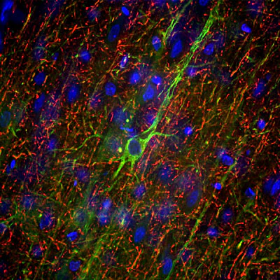 Anti-Neurofilament NF-M Antibody - Image 2