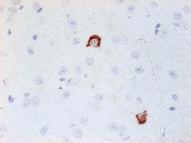 Anti-Neuropeptide Y Antibody - Image 4