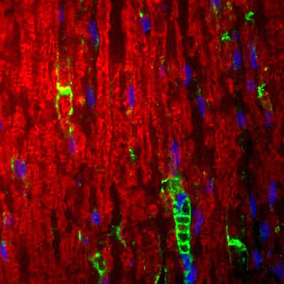 Anti-P-Zero Myelin Protein (PZO) Antibody