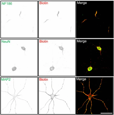 Anti-Pan-Neurofascin (Extracellular) Antibody - Image 5