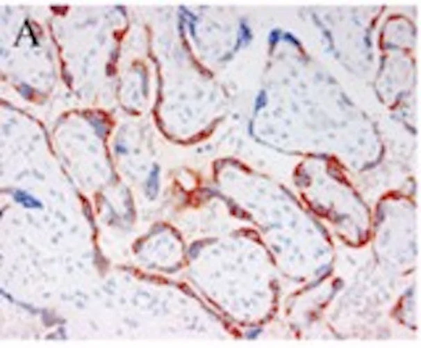 Anti-Pregnancy Associated Plasma Protein A (PAPP-A) Antibody - Image 2